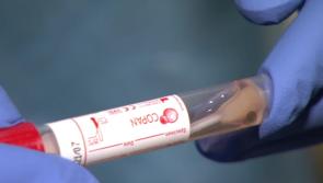 'Extremely worrying' - INMO warns of 350% rise in Covid hospitalisations