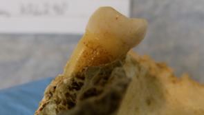 Brushing up on the Bronze Age: 4,000-year-old tooth found in Limerick