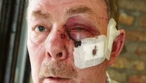 Limerick barman hailed as hero after tackling armed raiders