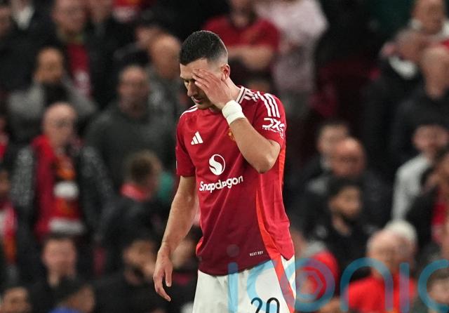Manchester United’s Diogo Dalot could miss rest of season with calf injury