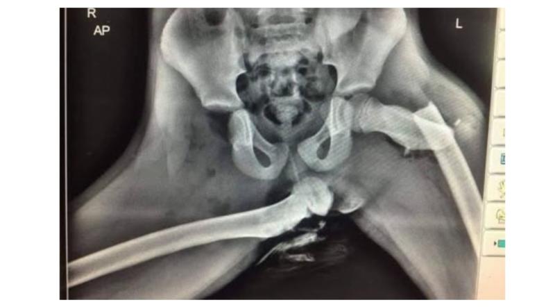 Gardaí share bone-chilling warning of risk sitting this one way in a car